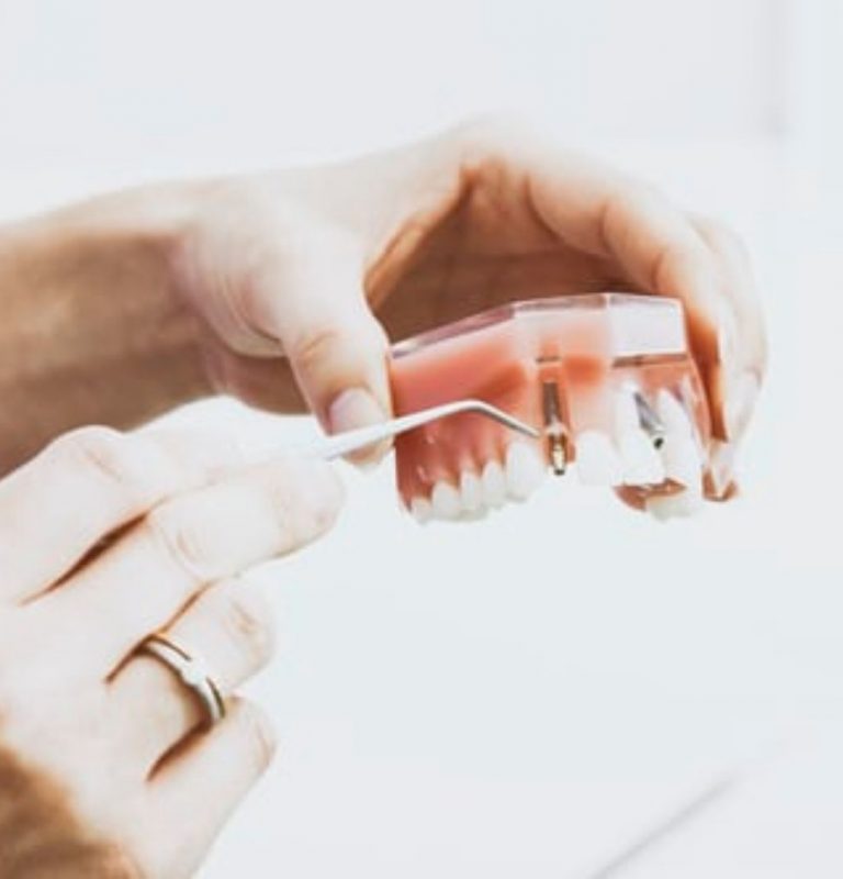 The Most Common Dental Problem - Pyria