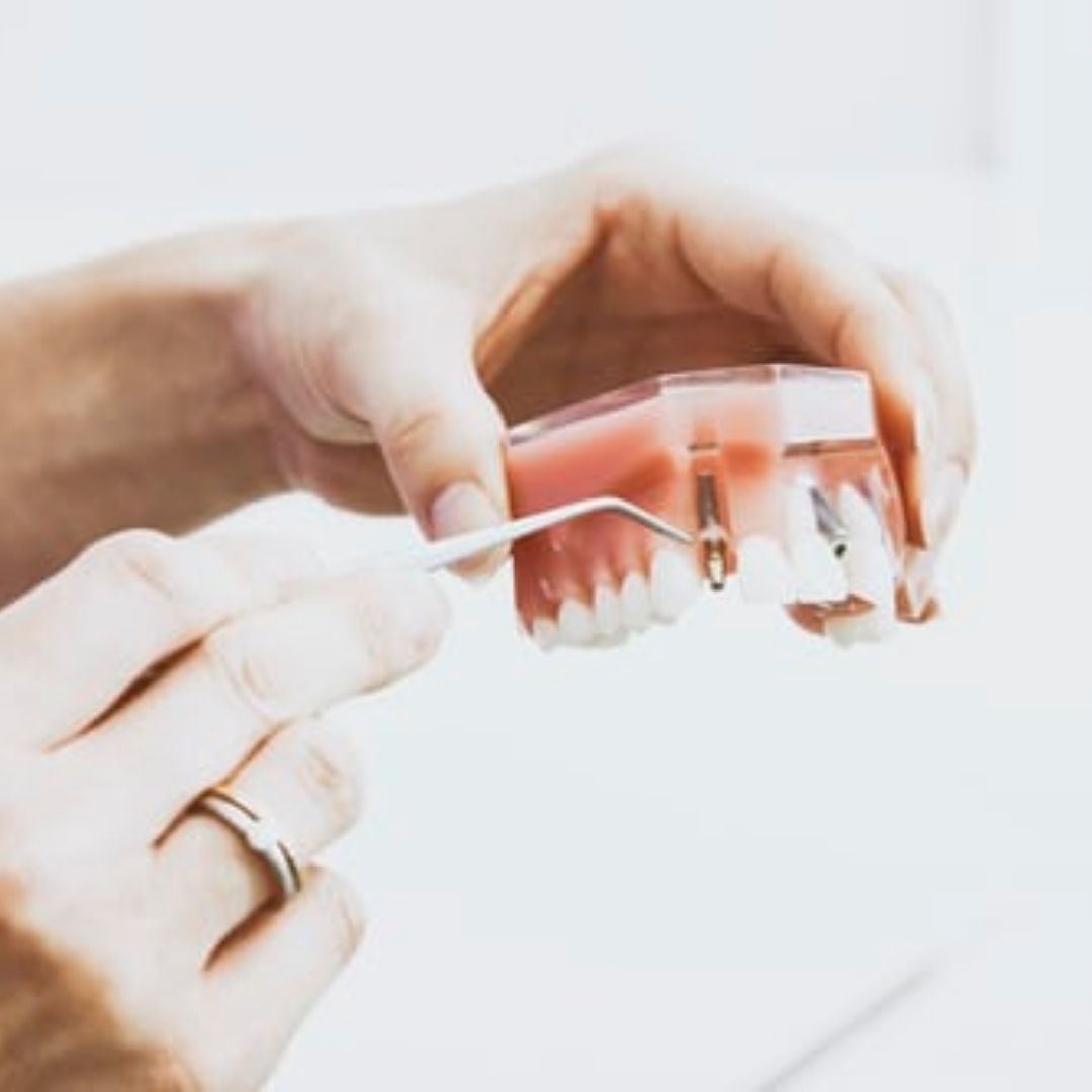 The Most Common Dental Problem - Pyria