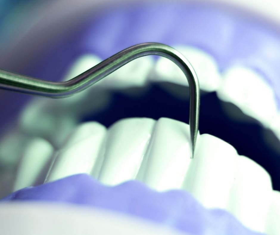 Root Canal Treatment